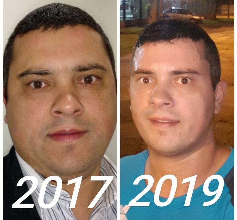 joão ricardo antes e depois