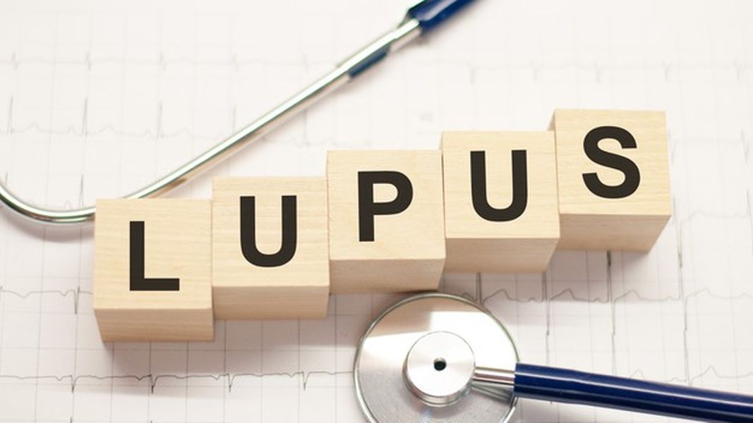 lúpus