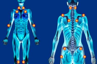 Projeto de lei que inclui fibromialgia nos direitos das Pessoas com Deficiência avança em primeira discussão
